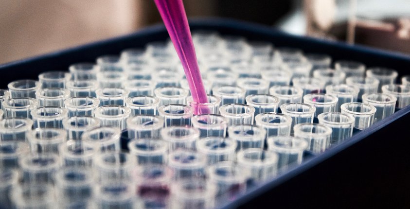 Join an EPC project or clinical study